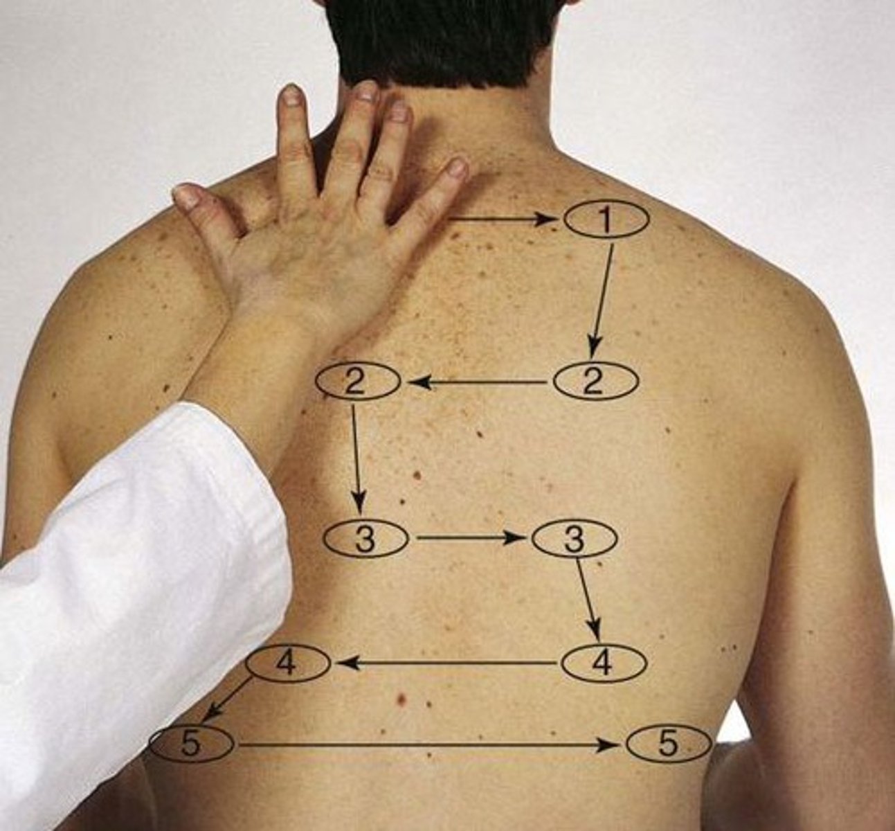 <p>using palmar base of finger or ulnar edge, touch chest while patient says "99", moving in a zig-zag pattern from the apices and palpate from side to side or compare sides<br><br>*vibrations should be equal b/l<br>*increased tactile fremitus = consolidation of lung tissue (e.g. pneumonia)<br>*decreased tactile fremitus = obstruction in bronchi, PE, emphysema</p>