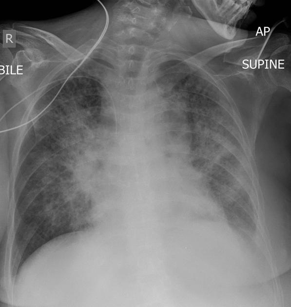 <p>Describe the abnormality demonstrated.</p>