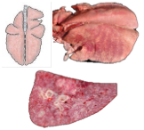 <p>What pattern of lung pathology? Describe it. 2 example causes.</p>