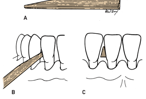 <p>Wooden/plastic triangular stick</p>