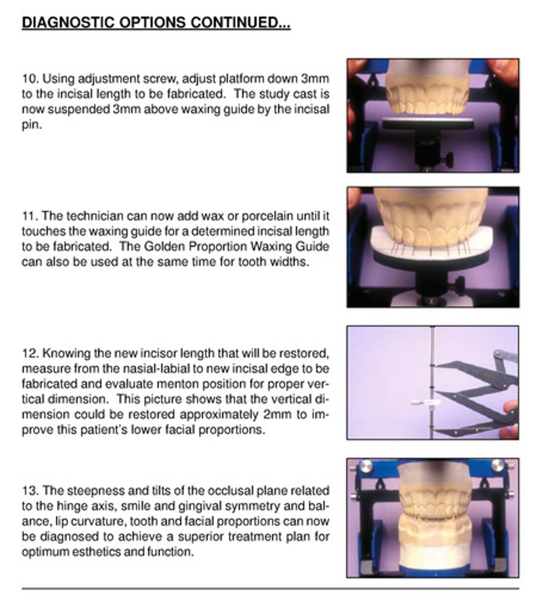 <p>1) using adjustment screw, adjust kois platform down 3mm to the incisal length to be fabricated; study cast is now suspended 3mm above waxing guides by incisal pin</p><p>2) technician can add wax or porcelain until it touches waxing guide for determined incisal length to be fabricated; golden proportion waxing guide can also be used at same time for tooth widths</p><p>3) knowing the new incisor length that will be restored, measure from the nasal-labial to new incisal edge to be fabricated and evaluate menton position for proper vertical dimension</p><p>4) picture shows that VD could be restored ~2 mm to improve pt's lower facial proportions</p><p>5) steepness and tilts of occlusal plane related to hinge axis, smile, gingival symmetry and balance, lip curvature, tooth and facial proportions can now be diagnosed to achieve a superior tx plan for optimum esthetics and function</p>