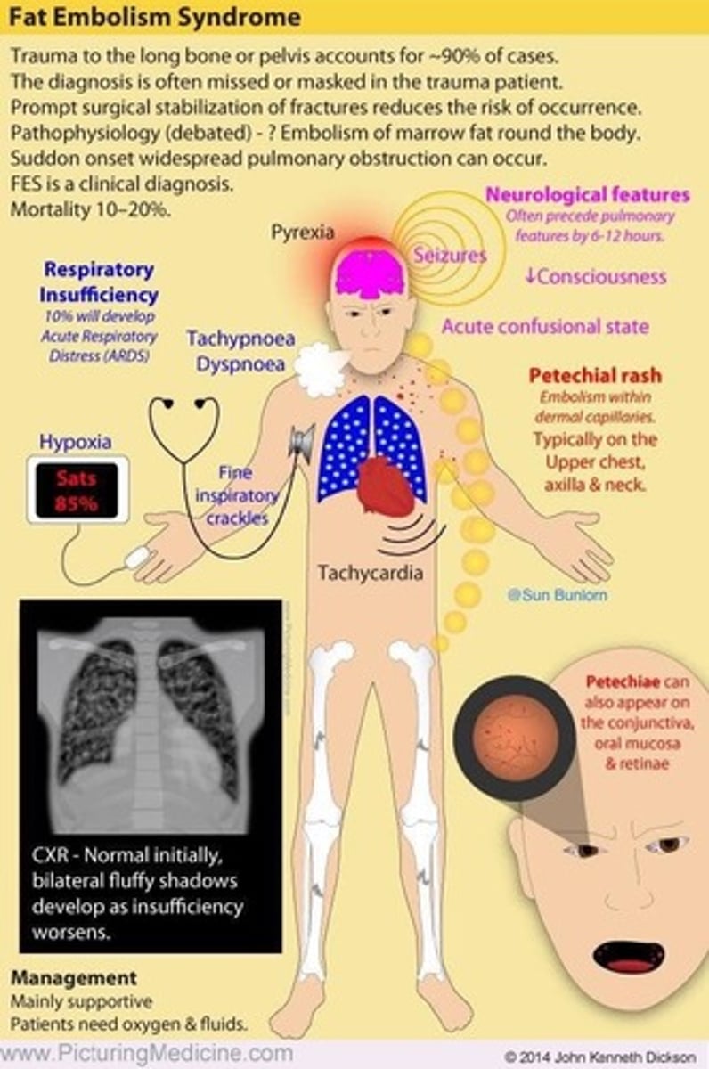 <p>- adipose tissue or bone marrow tissue migration into circulation</p><p>- with diffuse (widespread/non-localized) symptomology of interrupted perfusion</p>