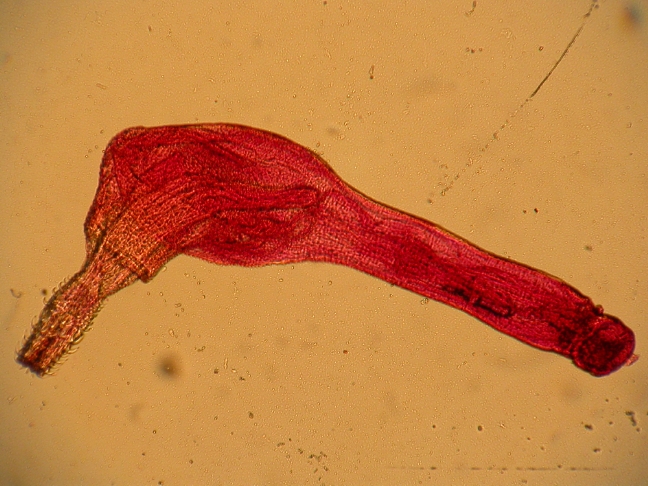 <p>Adult thorny headed worm</p><p>Fish, aquatic birds, certain mammals</p>