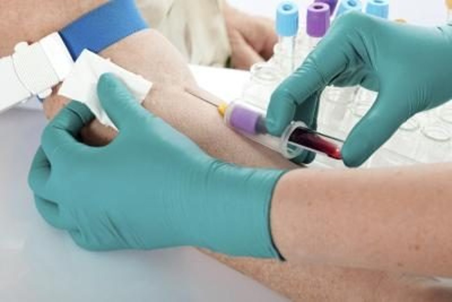 <p>Incision into a vein (the technical term for drawing blood)</p>