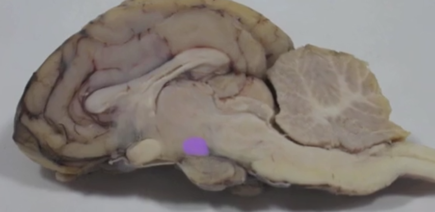 <p>Mammillary Body </p>
