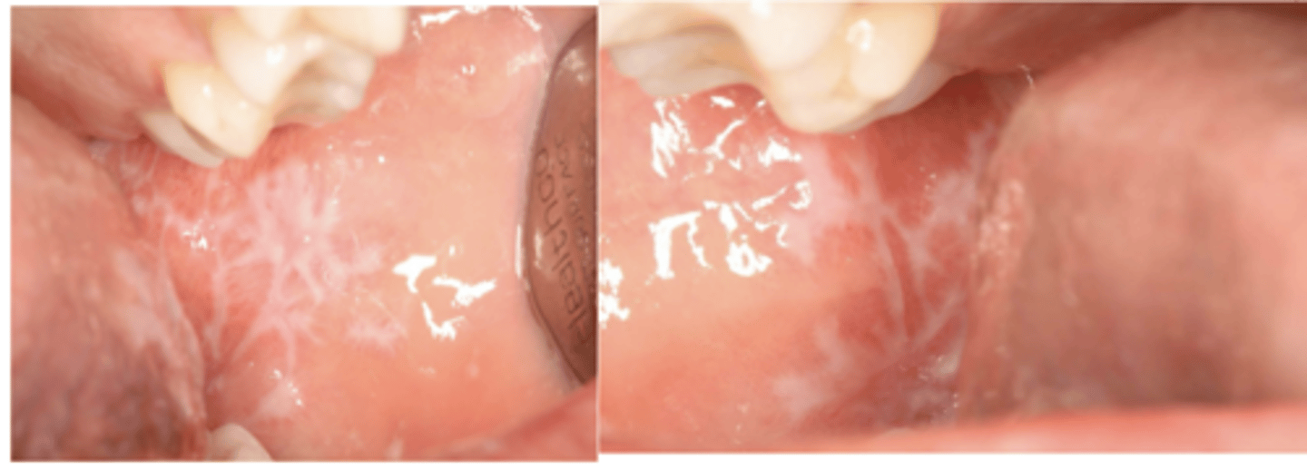 <p>What condition?</p>