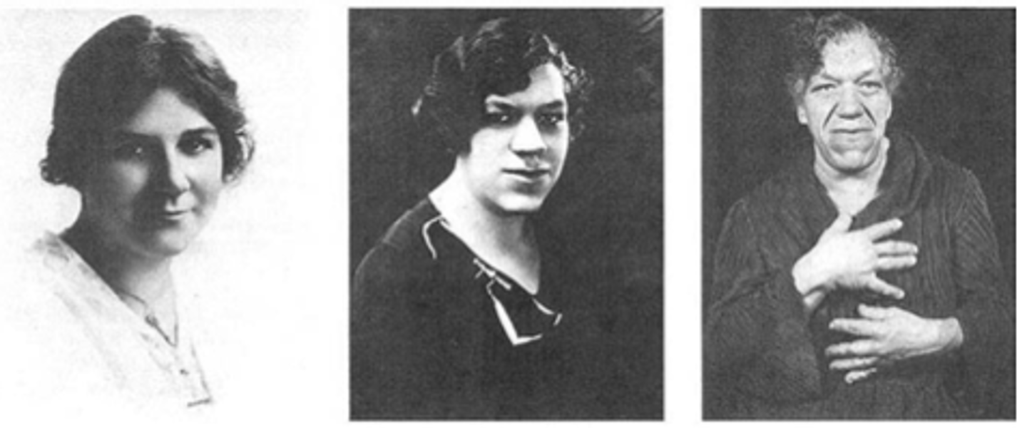 <p>Hypersecretion of growth hormone in adults, leading to the thickening of bones in the hands, feet, and face.</p>