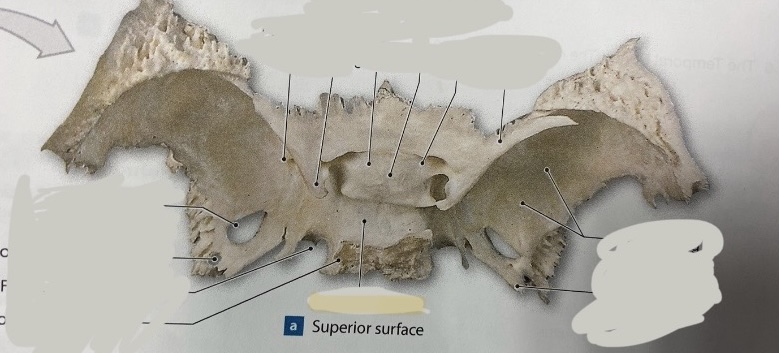 <p>What is the structure? </p>