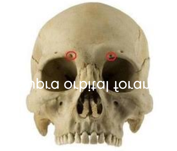 term image