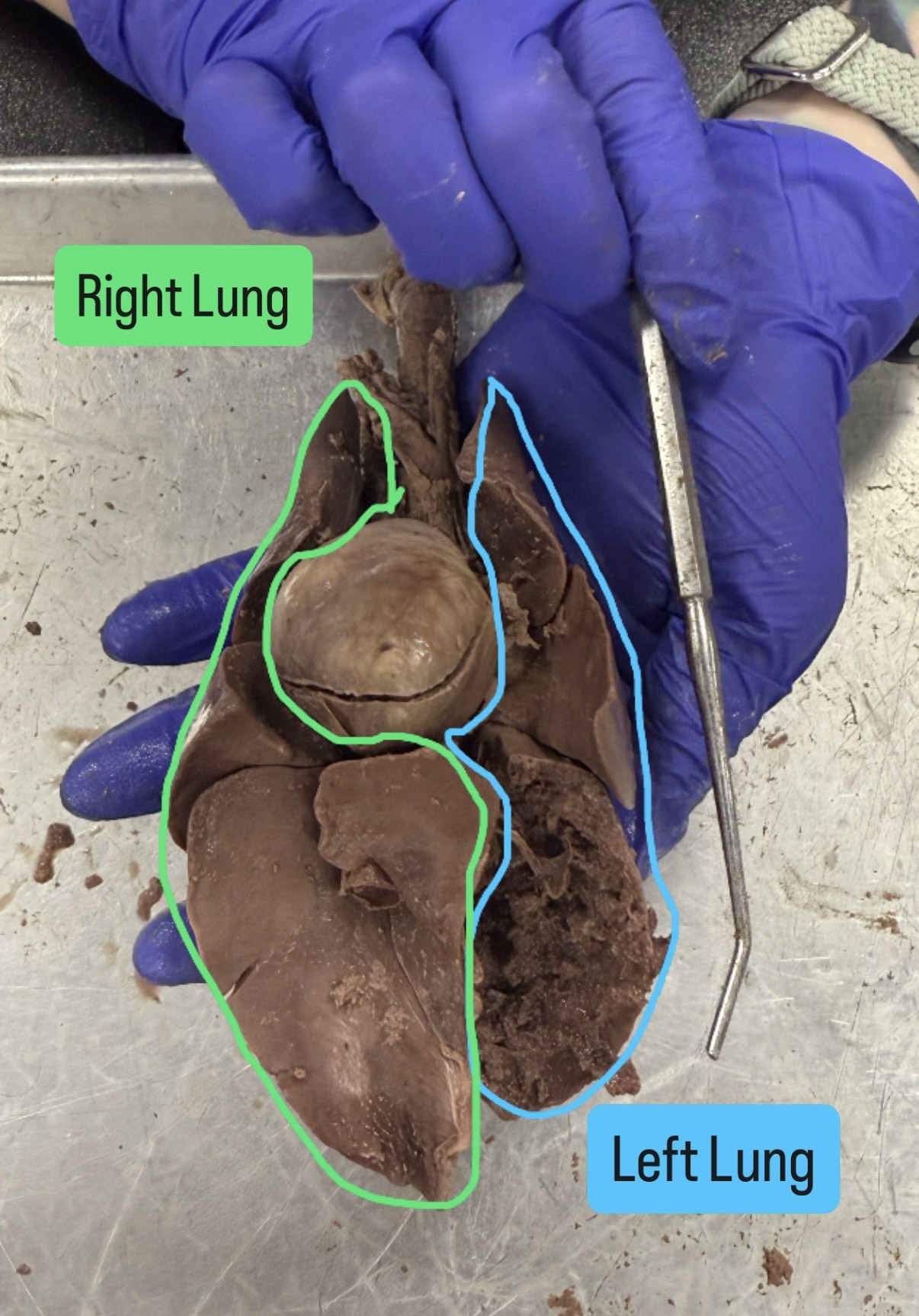 <p>Right lung and left lung</p>