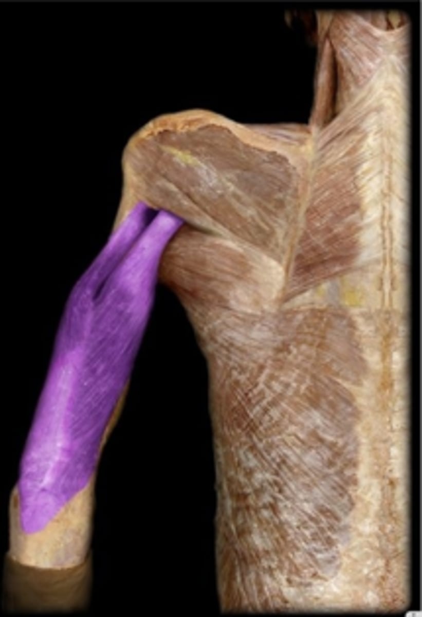 <p>What is the name of this muscle, highlighted in purple ?</p>