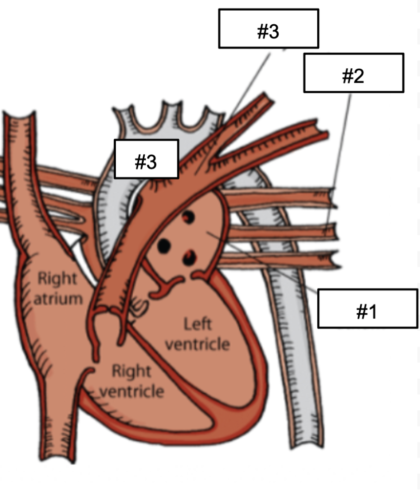 <p>#3?</p>