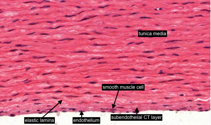 Aorta - elastic artery (tunica intima focus)
