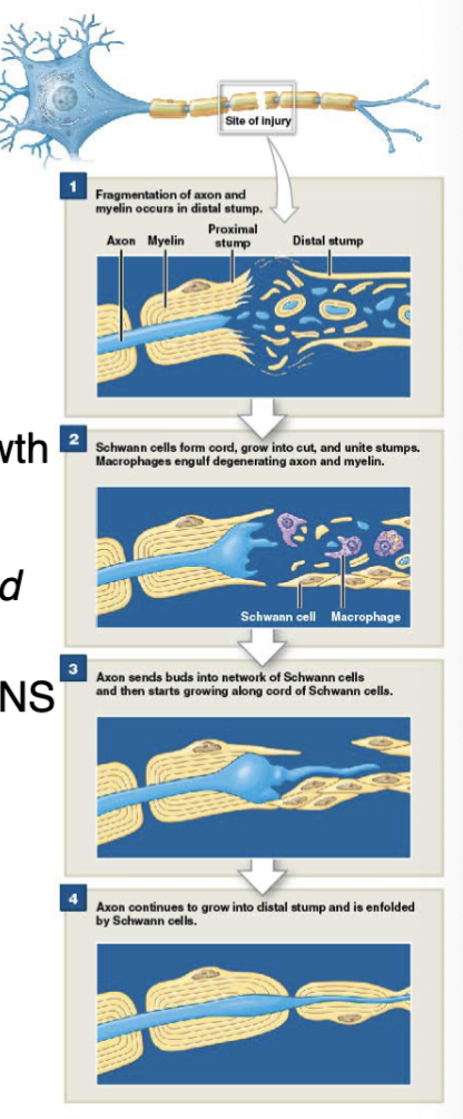 <p>• Neurons have limited ability for regeneration<br><strong><u>• CNS</u></strong><br>• little to no repair<br>• <strong>Neuroglia</strong> inhibit axonal regrowth<br>• <strong><u>Astrocytes</u> </strong>proliferate rapidly following injury →<br><strong>scar tissue</strong> develops = <u>physical barrier</u> to regrowth<br></p><p><strong><u>• PNS****</u></strong><br>• Intact <strong>cell body</strong> &amp;<u> active </u><strong>Schwann cells </strong>required<br>for repair/regrowth to occur<br><mark data-color="blue"> </mark><strong><u><mark data-color="blue">• Wallerian degeneration: </mark></u></strong>repair mechanism (nerves) in PNS<br>• S1: <strong>axon </strong>distal to injury site deteriorates<br>• S2: <strong>macrophages<u> </u></strong><u>phagocytize </u>debris<br>• S3:<strong> Schwann cells divide</strong> → form solid cord that<br>follows original axon path<br>• S4: Schwann cells release <u>axonal growth factors</u><br>• cut axons: regrowth in hours<br>• crushed/torn axons: 1 or more weeks</p><p></p><p>Motorcyclist injures nerve in leg, why doesn’t it repair itself? Cell body not in tact &amp; no active Shwann cells. PNS is for legs and has nerves</p>