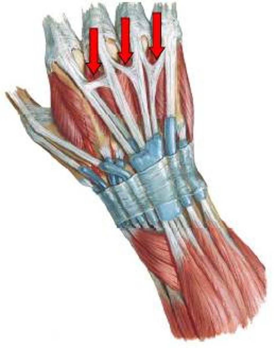 <p>Connective tissue band linking adjacent</p><p>tendons of the EDC proximal to the</p><p>MCP joints</p><p>- Highly variable structure</p><p>- Assist in centralizing the extensor tendon</p>