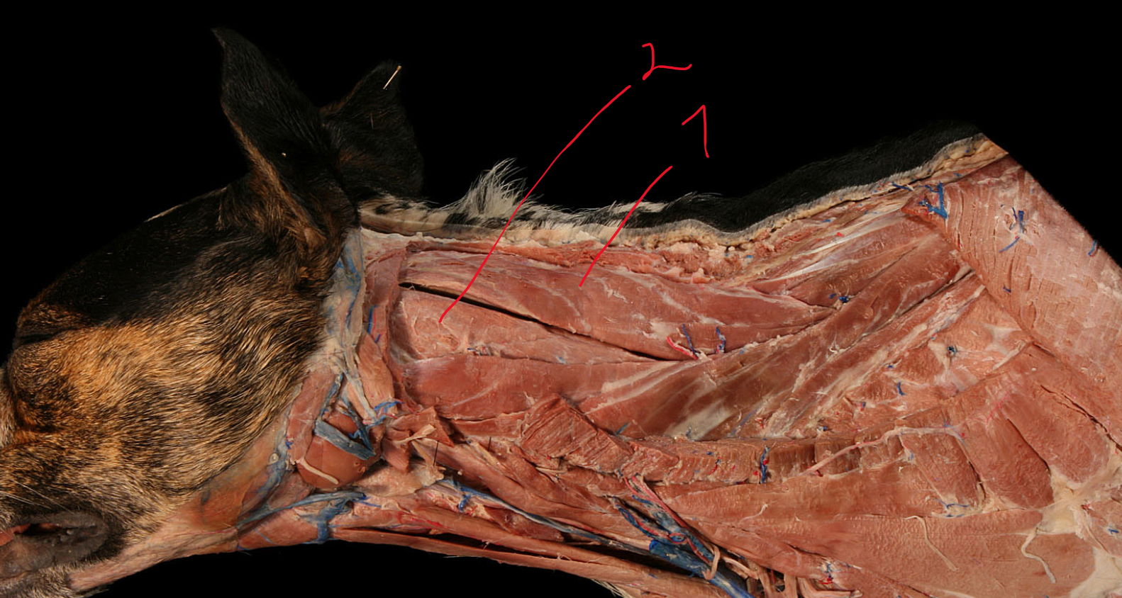<p>m. semispinalis capitis is divided into? </p>