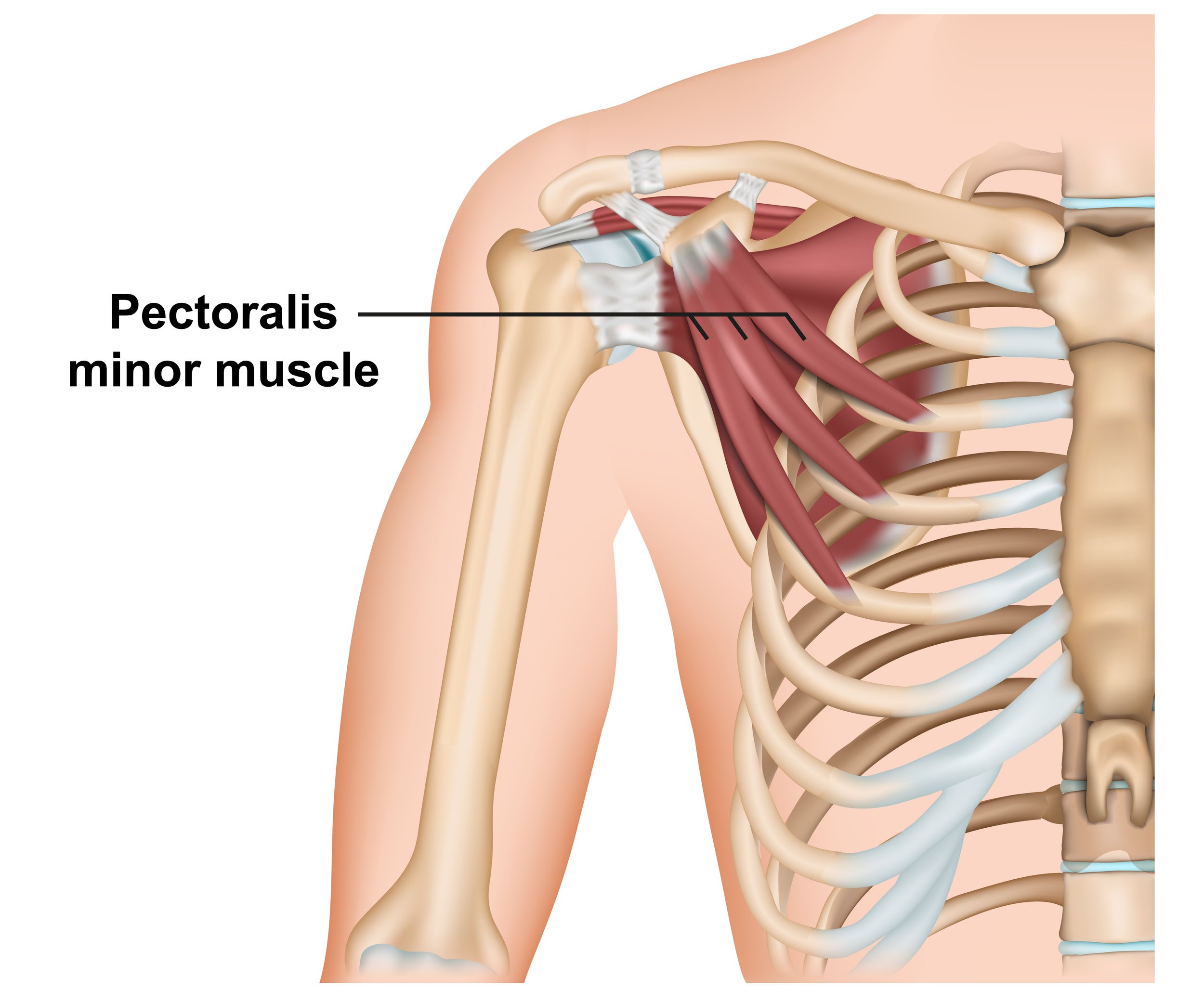 <p>Location:</p><ul><li><p>upper part of the chest</p></li><li><p>beneath the pectoralis major</p></li></ul><p></p><p>Function:</p><ul><li><p><strong>stabilization of the scapula</strong></p></li><li><p>assist in rib elevation during deep inspiration</p></li></ul><p></p>