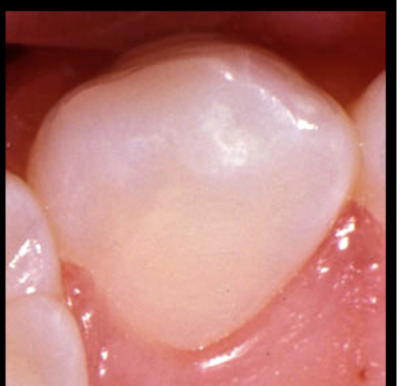 <p>Tooth #, Eruption, and Root Formation</p>