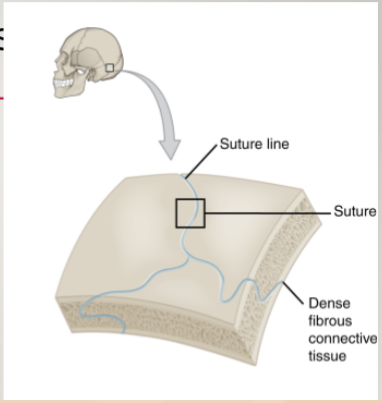 <p>bones protecting internal organs</p><p>fibrous sutures of skull</p><p>cartilaginous manubriosternal joint</p>