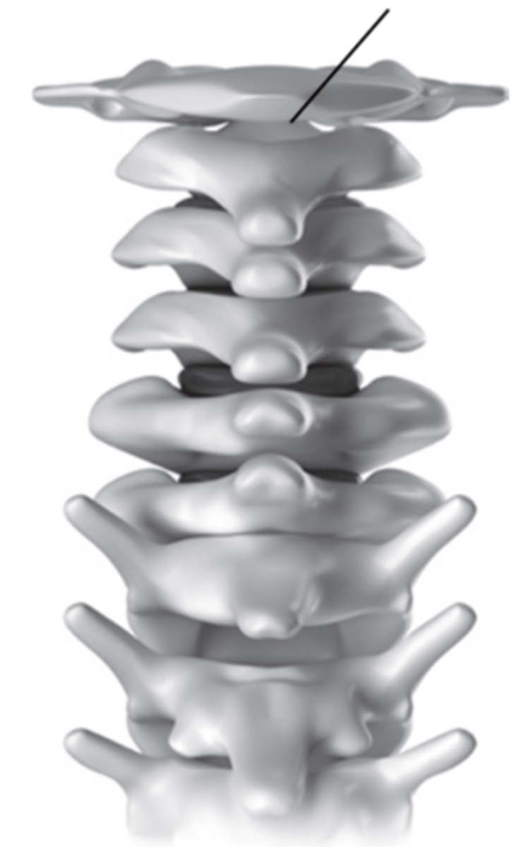 <p>What is the structural classification of this joint?</p>