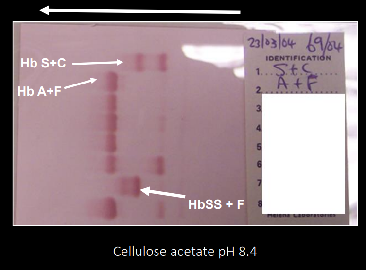 <p>cellulose acetate electrophoresis</p>