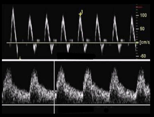 <p>Which waveform is low-resistance and which is high-resistance?</p>