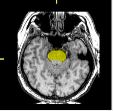<p>What part of the brain is highlighted?</p>