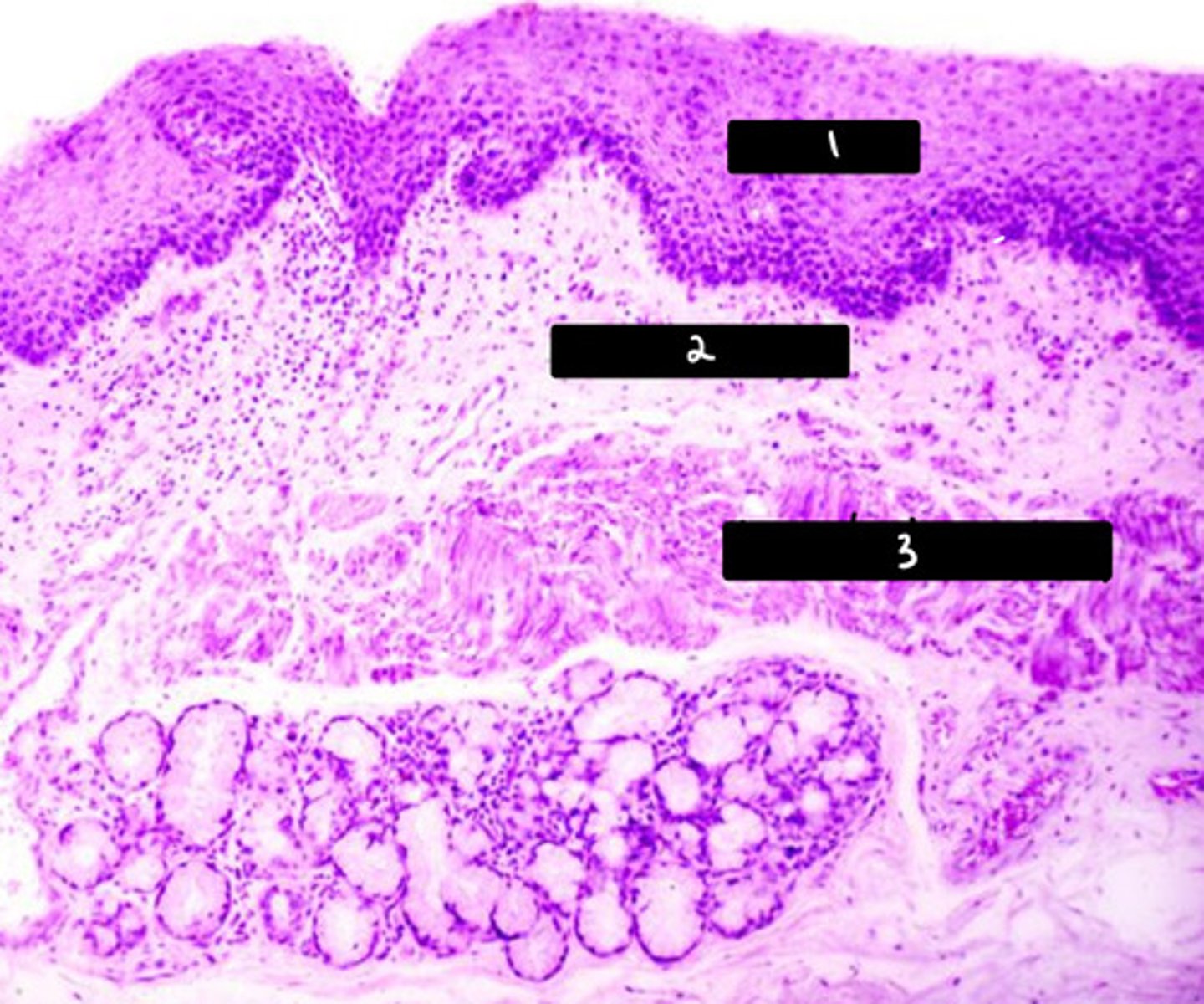 <p>submucosal</p>