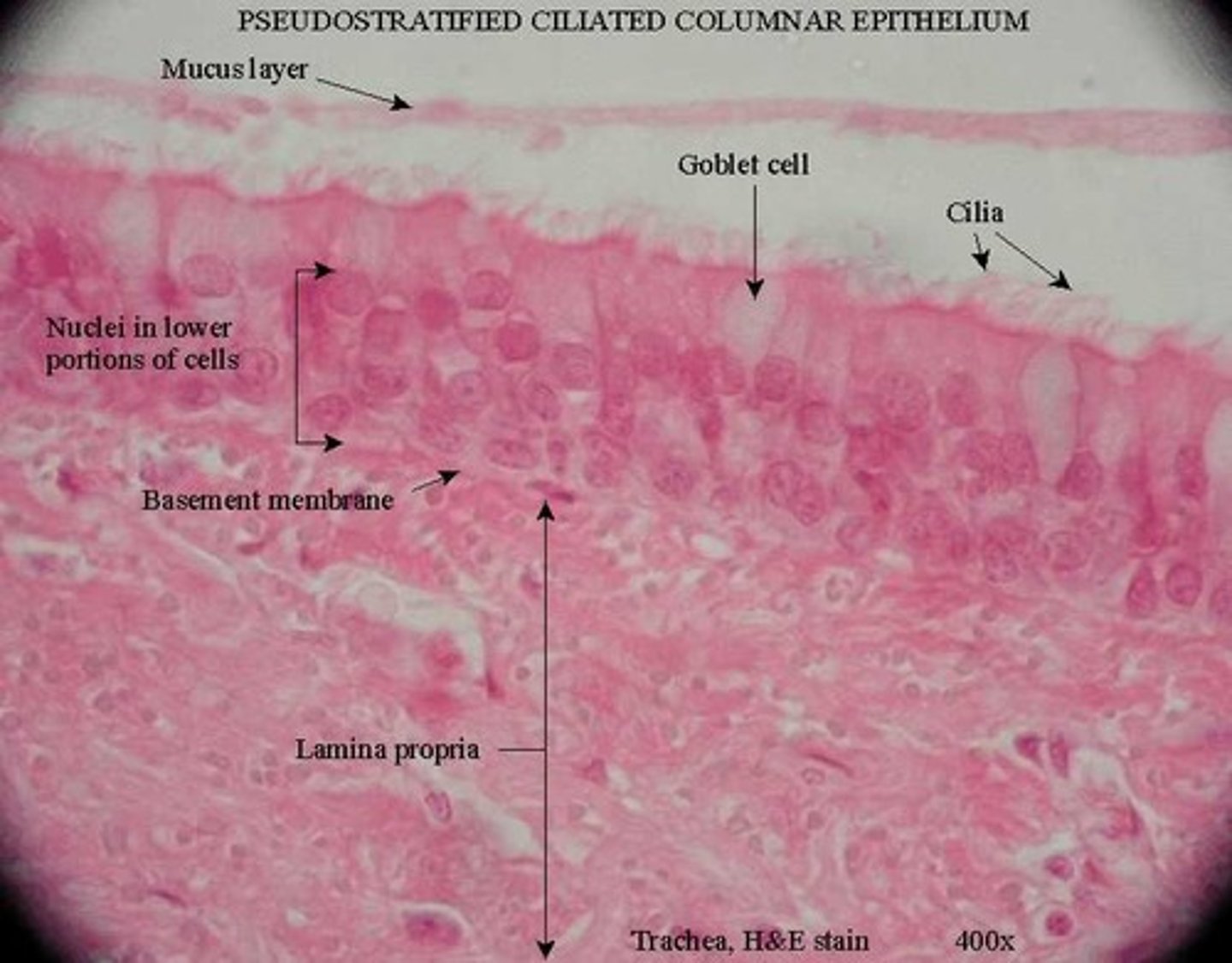 <p>Movement of mucus in trachea and bronchi</p>