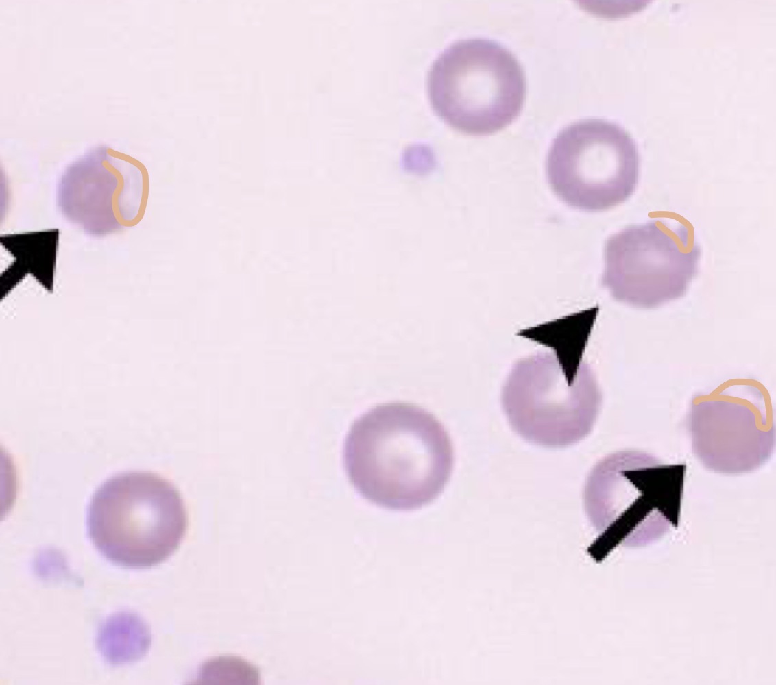 Name this RBC Abnormality.