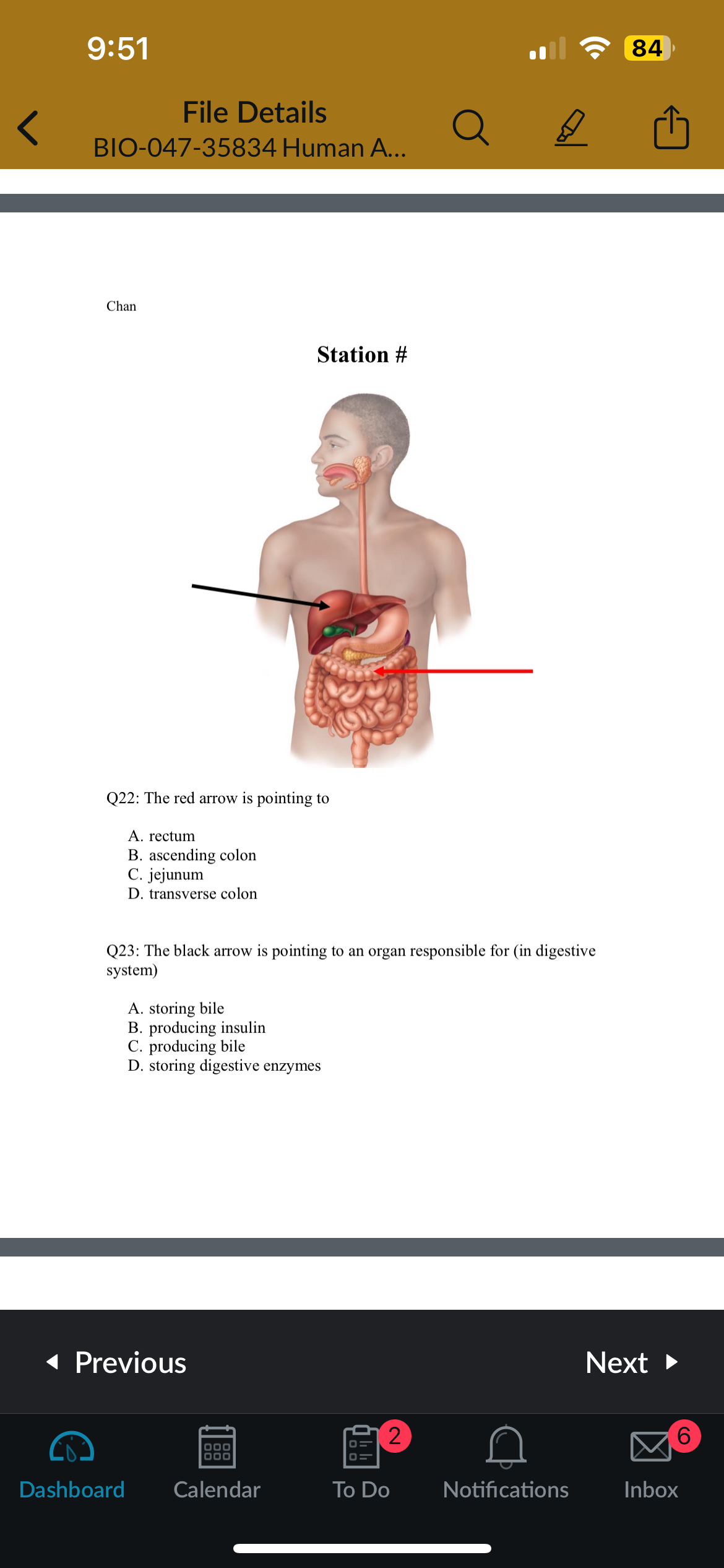 <p>Q23: The black arrow is pointing to sn organ responsible for (in digestive system)</p>