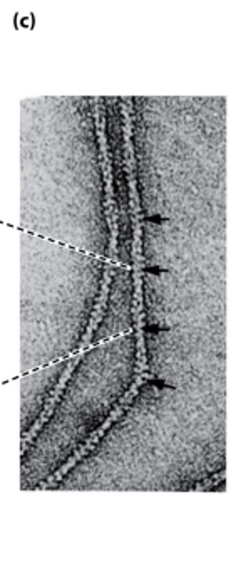 <p>_______-negatively stained actin filaments appear as long, flexible, and twisted strands of beaded actins</p>