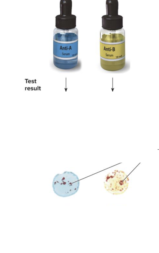 <p>Name the blood type</p>