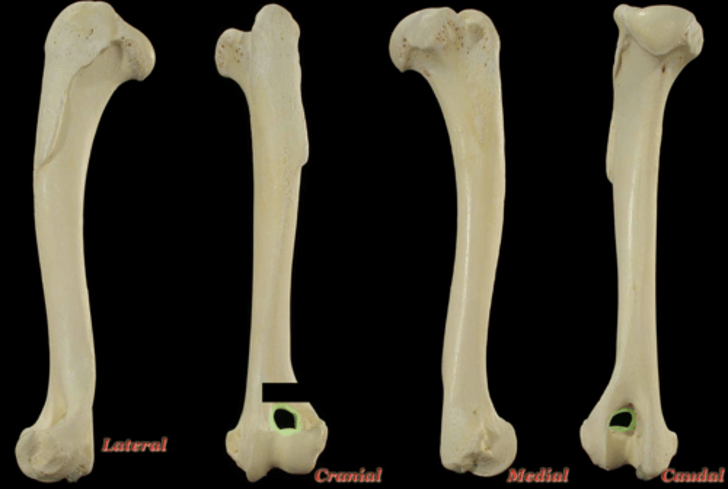 <p>What structure is highlighted in the picture?</p>