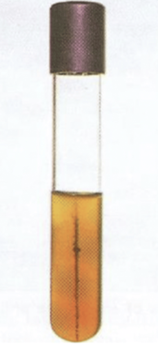 <p>which bacteria produces this result?</p>