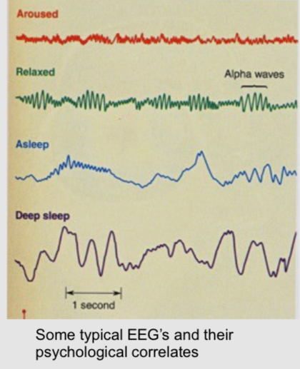 <ul><li><p>it is a measure of electrical activity in the brain that uses macro electrodes (metal discs) attached to the scalp </p></li><li><p>It records the summed up population level activity of millions of neurons </p></li><li><p>It can be used as a diagnostic stool </p></li><li><p>Specific patterns are associated with consciousness, sleep stages, etc</p></li></ul><p></p>