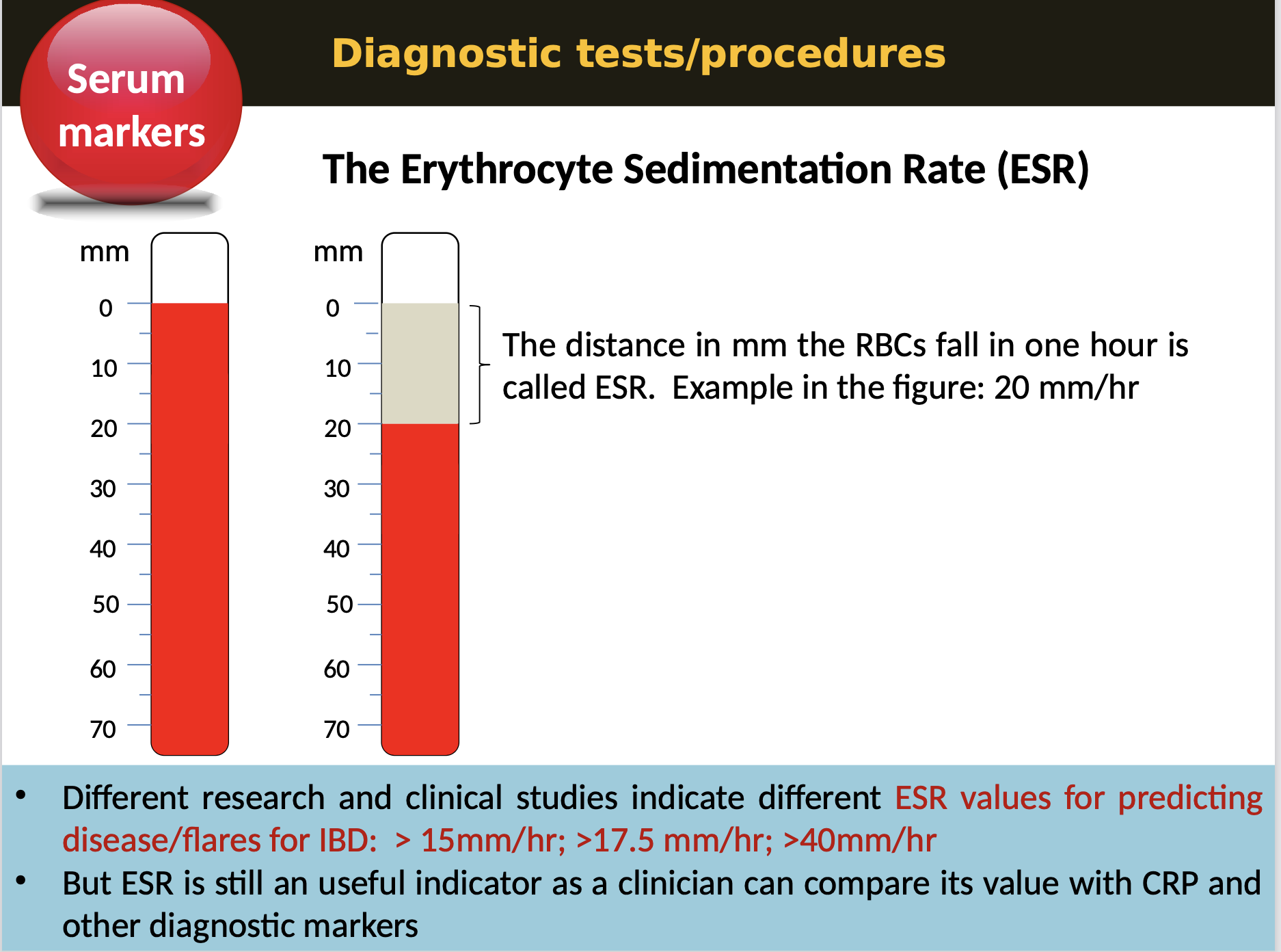 <p><strong>Serum markers - </strong>ESR is a blood test that measures the rate at which red blood cells settle at the bottom of a test tube, indicating inflammation.</p><p>When an inflammatory process is present, the acute phase reactants in the blood cause red blood cells to stick to each other. </p><p>The RBCs form stacks called <strong>ROULEAUX</strong> that settle faster due to their increased density. This enhances the ESR.</p>