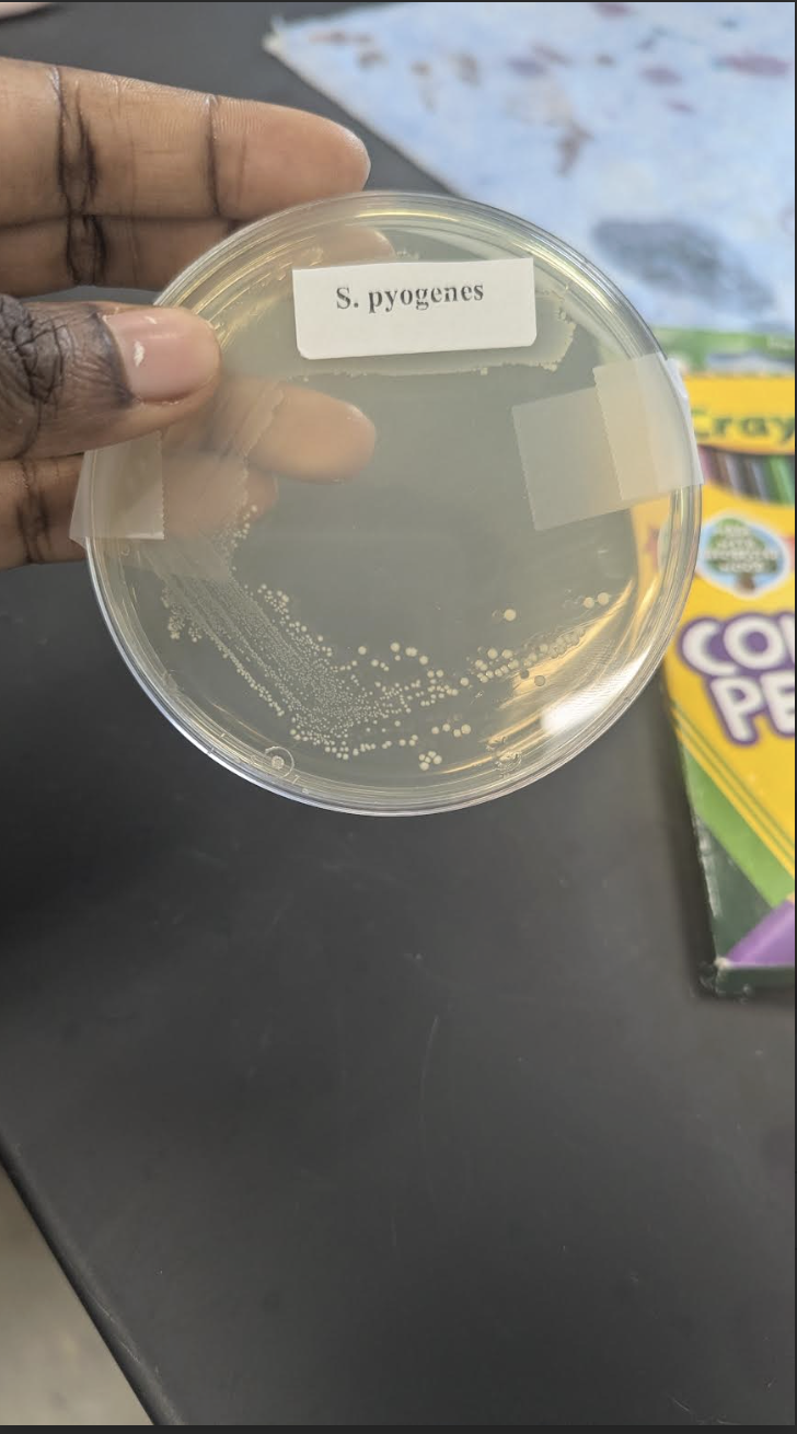 <p>Say the following about: Group A streptococcus pyogenes</p><p>Growth Medium:</p><p>Pigment:</p><p>is it diffusible:</p><p>Oxygen characteristics:</p>