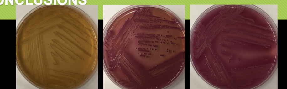<p>gram negative organisms</p>