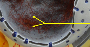 <p>The material consisting of DNA and proteins that makes up chromosomes in the nucleus </p>