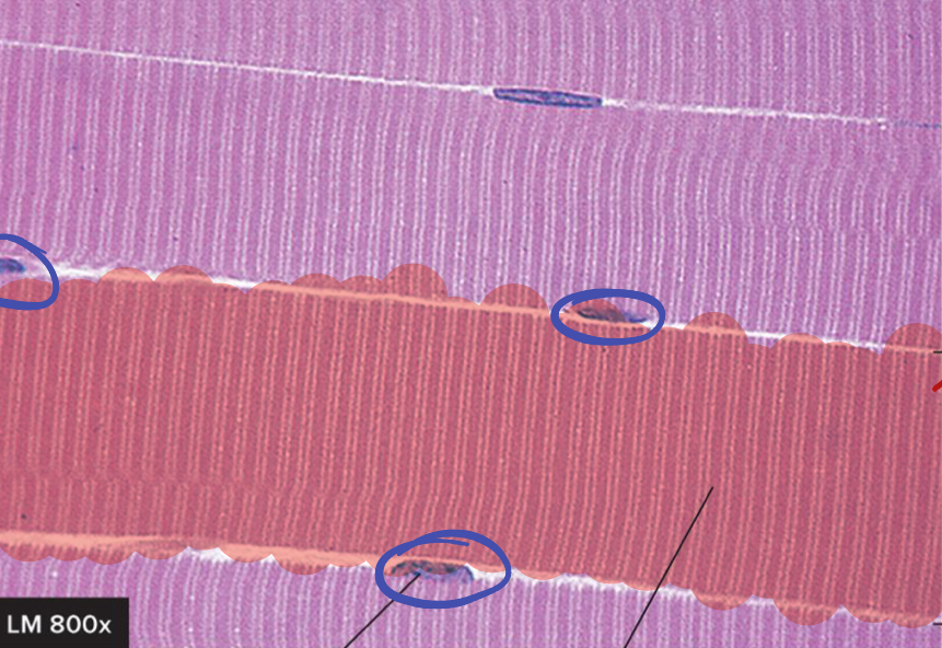 <p>What is circled in blue?</p>