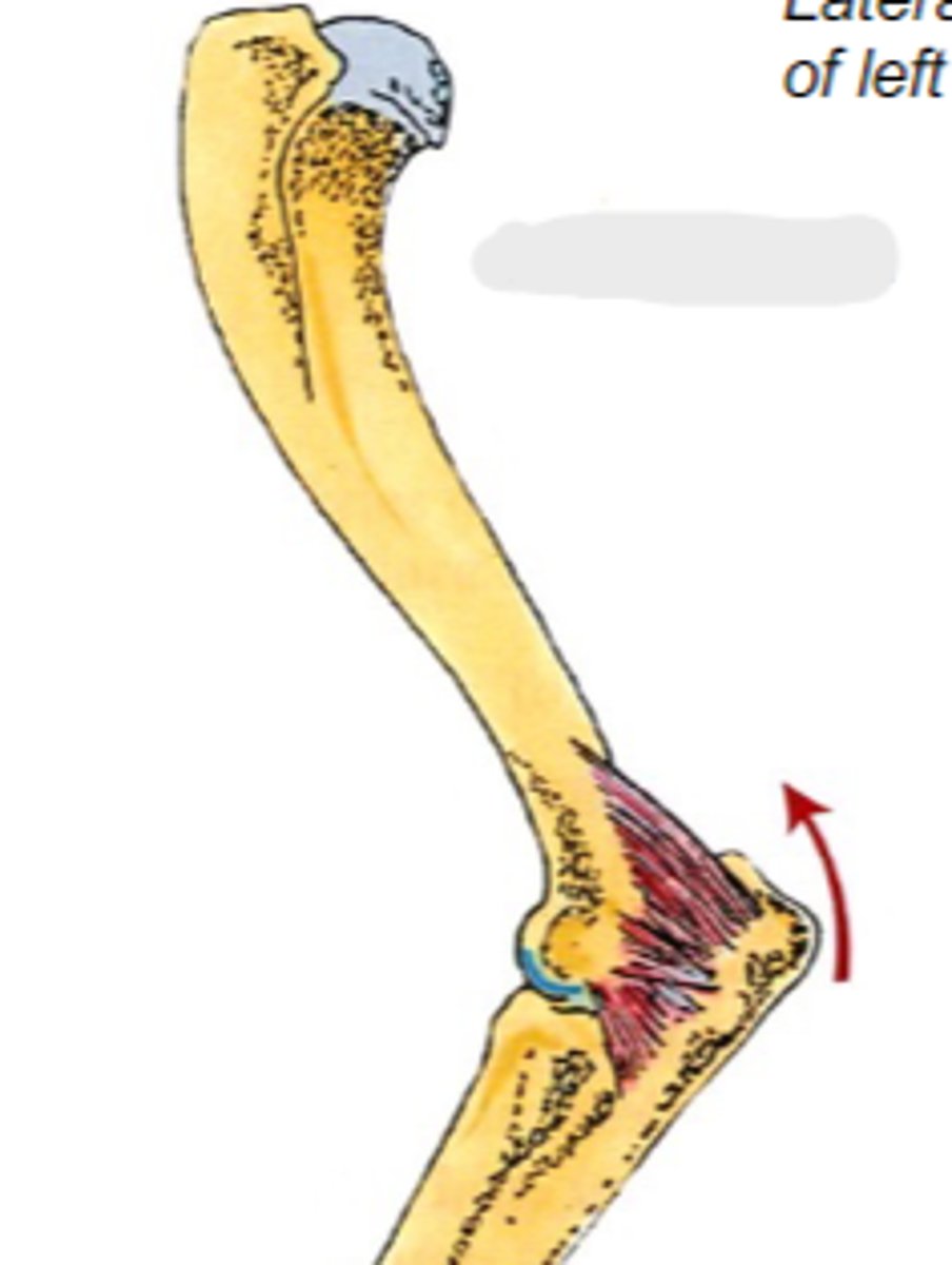 <p>What muscle is shown?</p>