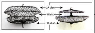 <p>which is the ASD</p><p>which is the PFO device</p>