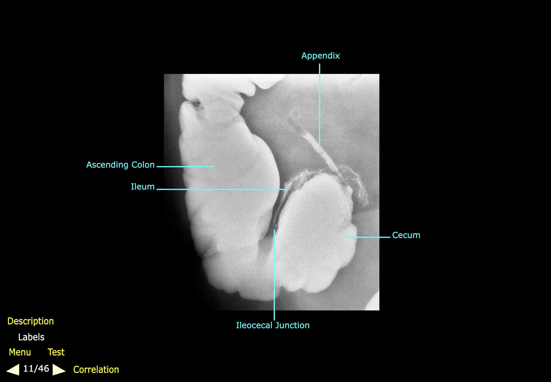 knowt flashcard image