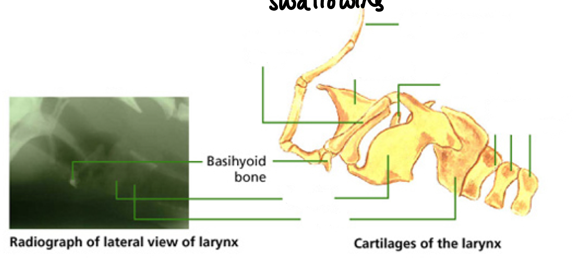<p>Use this diagram to name the parts of the larynx.</p>