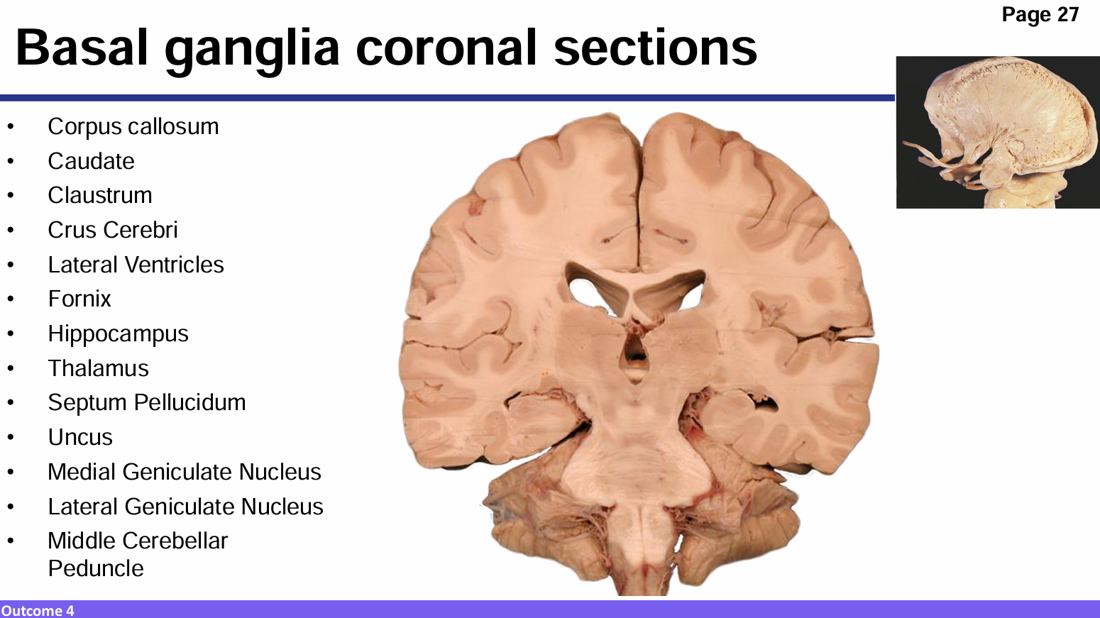 <p>Identify these structures and what part of the basal ganglia it is</p>