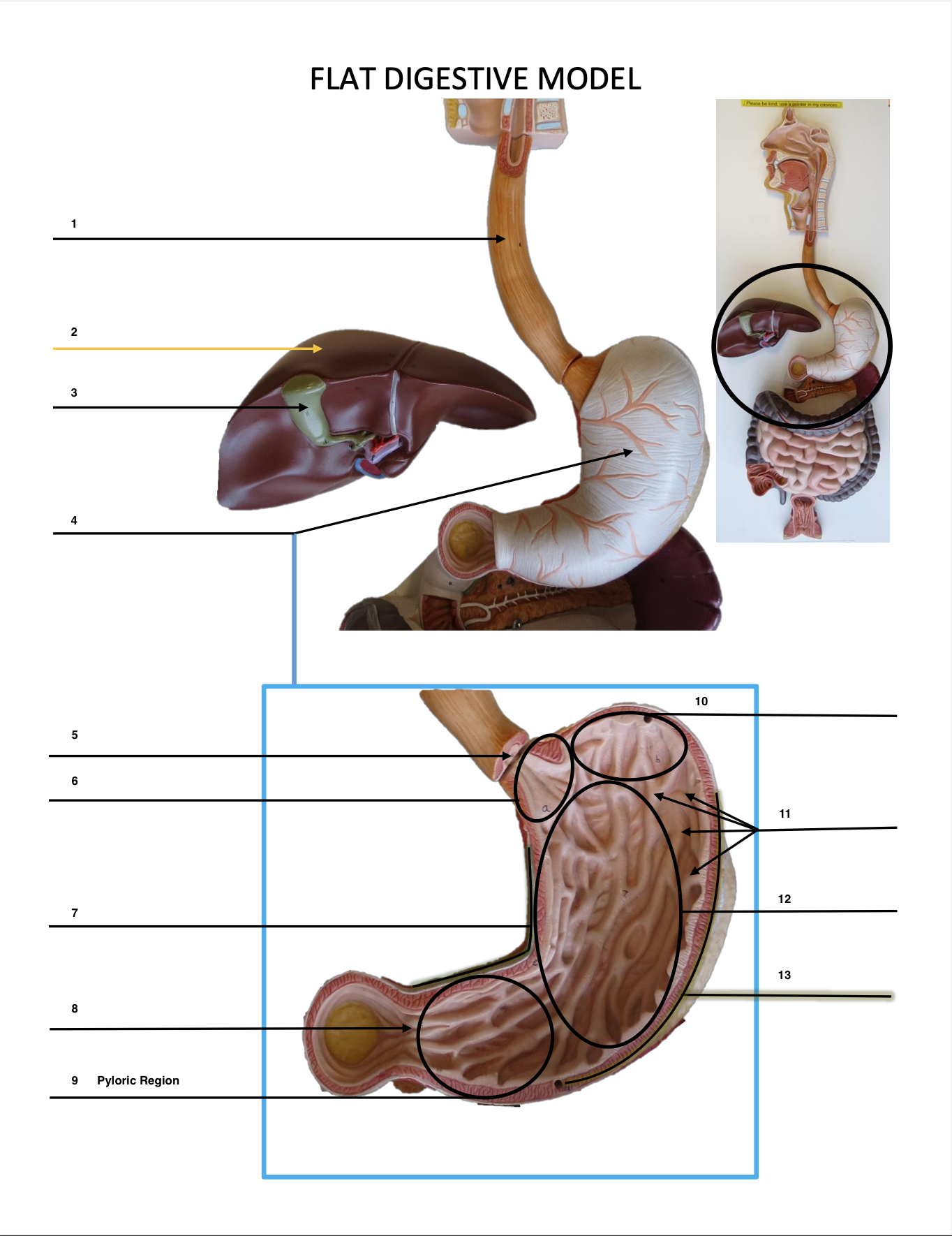 <p>Pyloric Region</p>