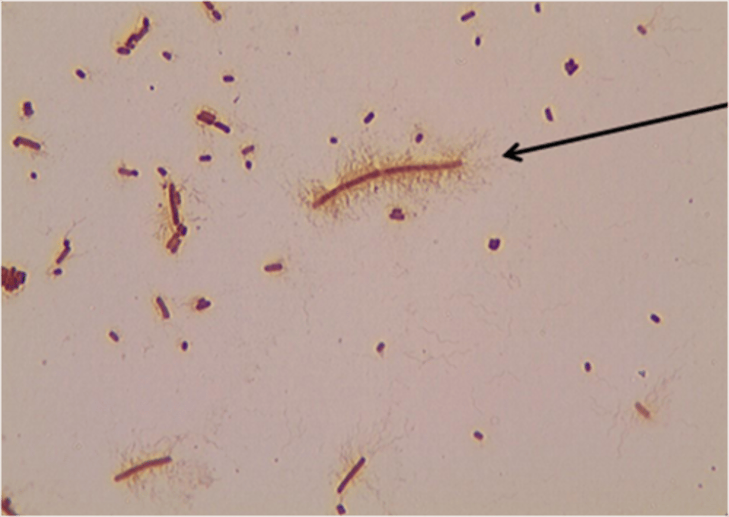 <p>What flagellar arrangement is pictured here?</p>