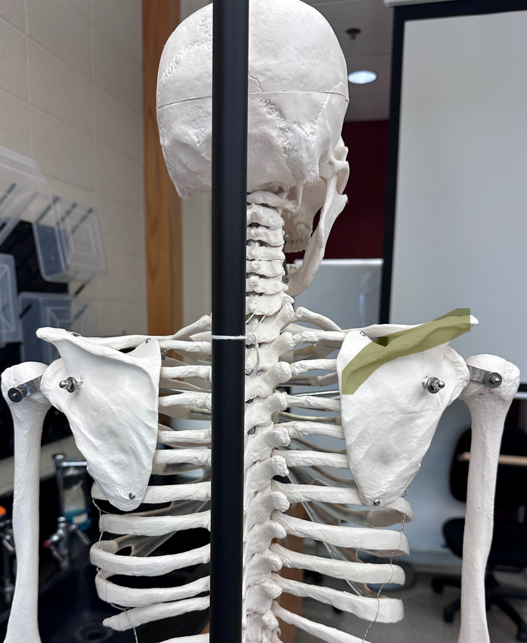 <p>Spine of the right scapula</p>