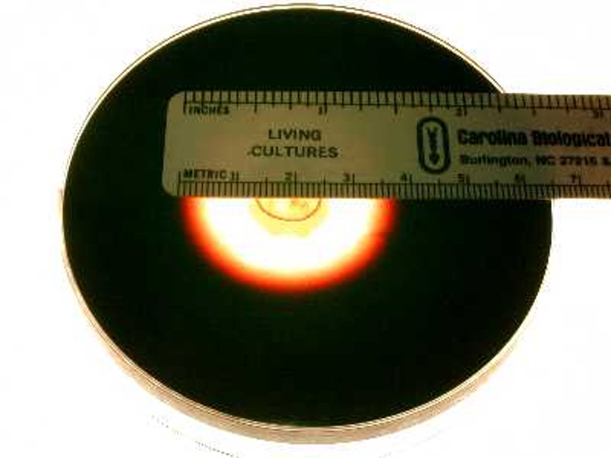 Media that tests for the production of the Amylase enzyme

\
Picture shows a positive result, as seen by the degradation

\
Microbes that produce a positive effect:


1. Bacillus Subtilis